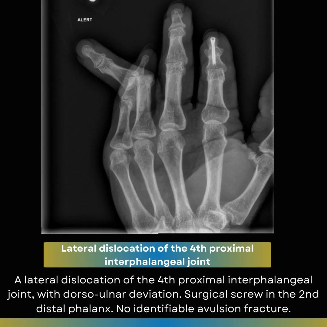 Orthopaedic Tutorials tweet media