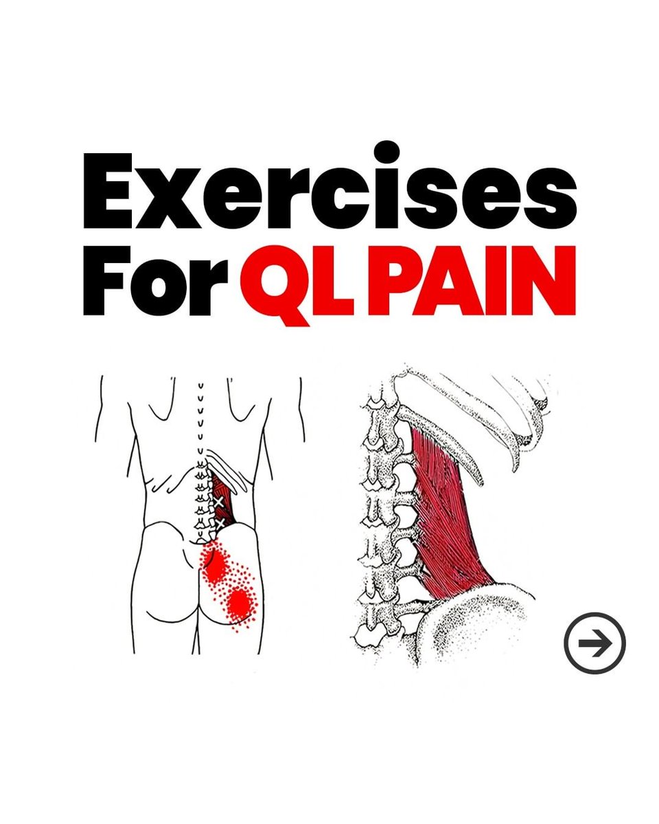 CadioArena's tweet photo. Exercises for QL Pain https://t.co/pzWS9VZkpB