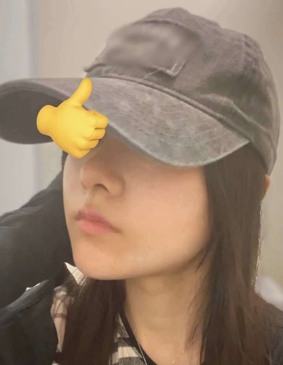 misochanq's tweet photo. シャープ整形外科で鼻フルしてから2ヶ月経ちました☺︎
私の理想の鼻にしてくださいました。
キムウンフェ先生にお任せしてよかったです☺︎ https://t.co/a0IwKwHuh0