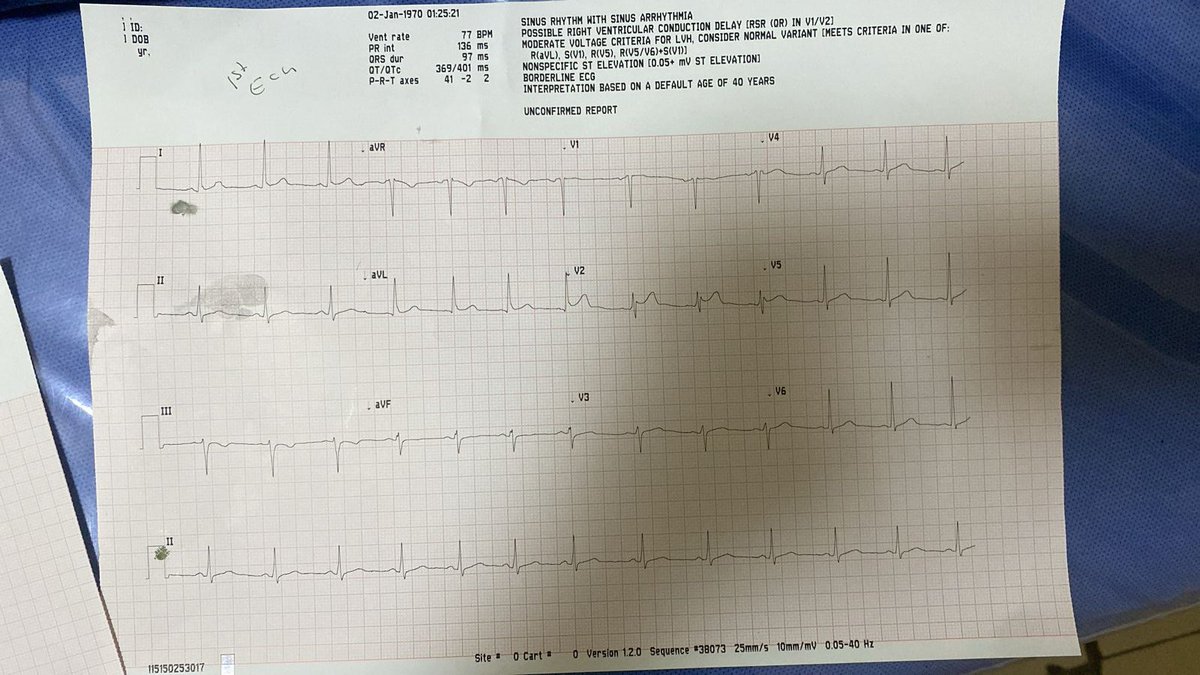 26 male
Atypical chest pain 
Thoughts ?