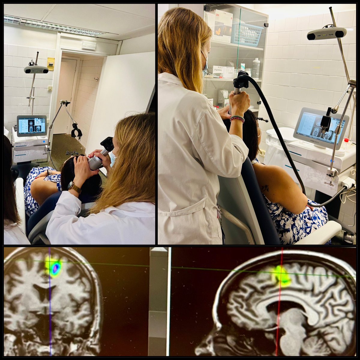 Transcranial Pulse Stimulation for the affective component of pain in the Neuromodulation Lab <a href="/hospitaldelmar/">Hospital del Mar</a> 
✅Pain and Neuromodulation Unit