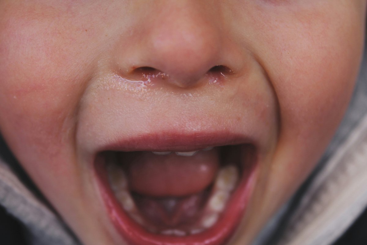 Division37ofAPA's tweet photo. There is consistent and strong evidence that spanking makes children’s behavior worse and increases
the risk of a range of harms, including more mental health problems and poor school performance. Read the research here: https://t.co/nJoyZ2rEtk https://t.co/WlXbUMIrfF