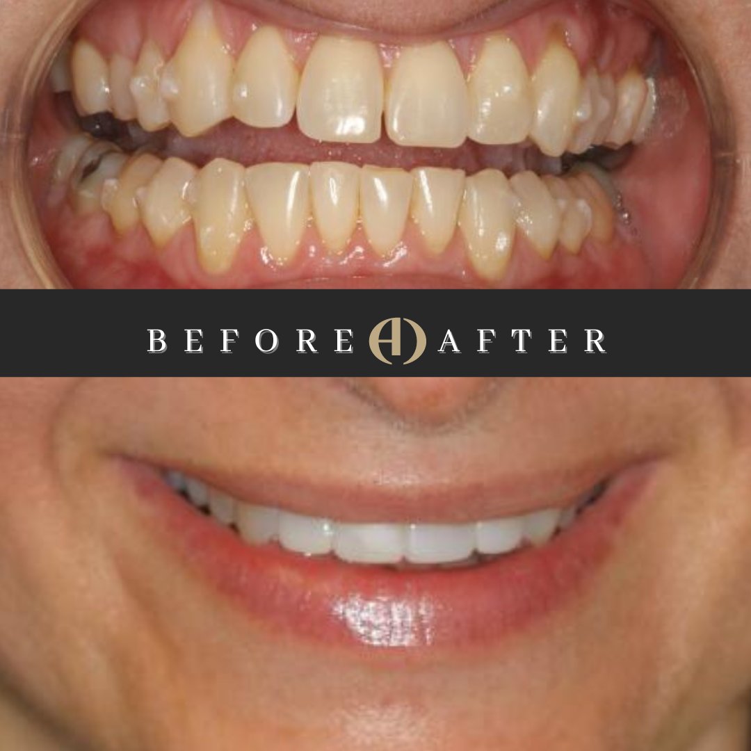 TheArtofDentistrySpa tweet media