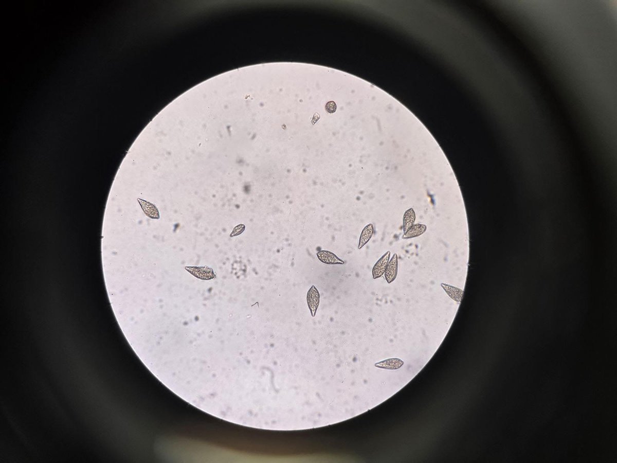 Onion downy mildew has been identified on transplant onions in the marsh. A protective spray is recommended ASAP. More info on managing the disease can be found in our latest IPM Report: bradford-crops.uoguelph.ca/system/files/M…