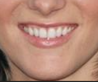 ca2cv's tweet photo. A qui un juego.. porque yo encuentre que la Belmo y Heather Morris de glee tienen la misma sonrisa.. y quiero saber si ustedes son capas de reconocer cual es la sonrisa de quien... 
La Belmo es A, B, o C? 
#Mafin https://t.co/1G5vlTBaus