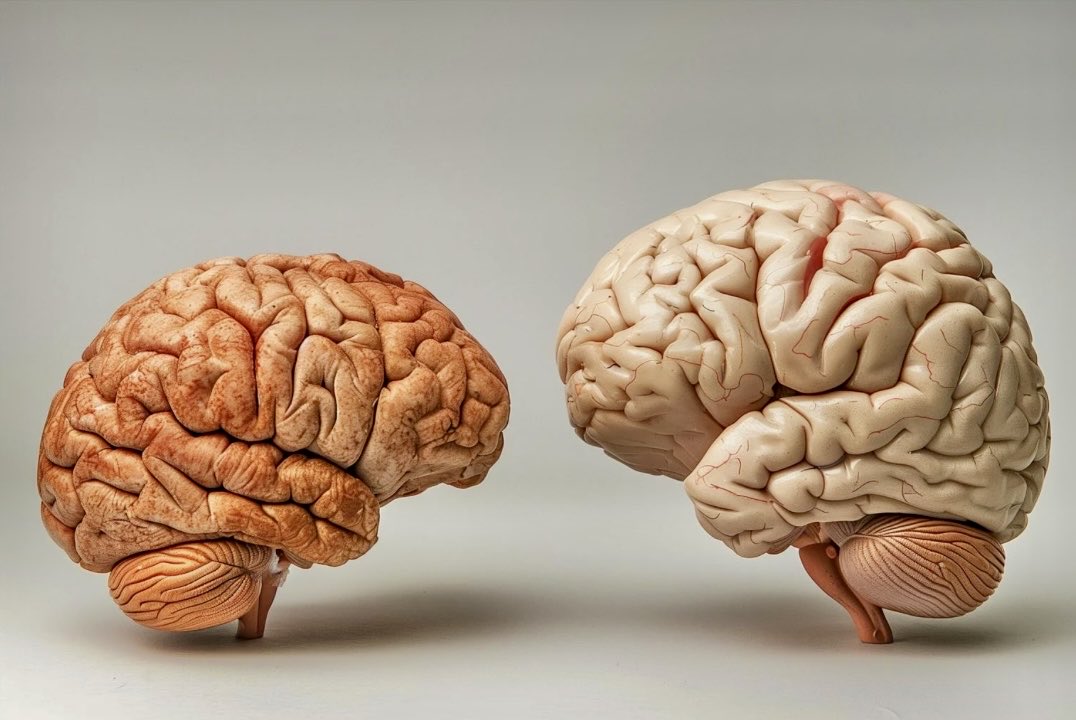 enilev's tweet image. 🧠 Brain #Size Myth Debunked With New #Evolutionary Insights

Source: @UniofReading 
@SciTechDaily1 
HT: @chidambara09 

#Brain #Neuroscience #Biology 

👉scitechdaily.com/brain-size-myt…

A new study involving 1,500 #species shows that #larger #animals do not have proportionally bigger