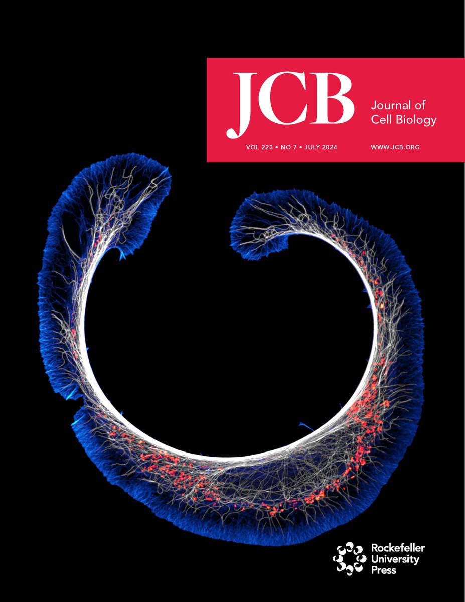 Our July issue is out: hubs.la/Q02Djy5W0 
Cover shows super-resolution spinning disk confocal image of a cath.a-differentiated (CAD) cell stained for F-#actin (blue), #microtubules (white) &amp; #mitochondria (red). By <a href="/CisternaBA/">Bruno</a> @chillinwithpfn1 et al. hubs.la/Q02Djj3N0