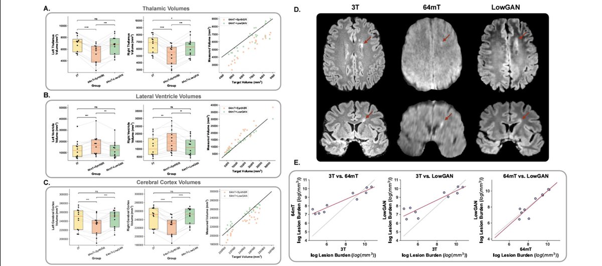 We won the #SIIM24 Best Scientific Paper Award! 🏆

Congrats <a href="/alfrelucs/">Alfredo Lucas</a>, outstanding lead work! Be sure to check out our multi-contrast algorithm for enhancing <a href="/Hyperfine/">Swoop® Portable MR Imaging® System–Hyperfine, Inc</a> low-field images.

Abstract: ecs.page.link/sc4FP
Preprint: bit.ly/LowGAN_Rxiv

🙏 <a href="/SIIM_Tweets/">SIIM</a>