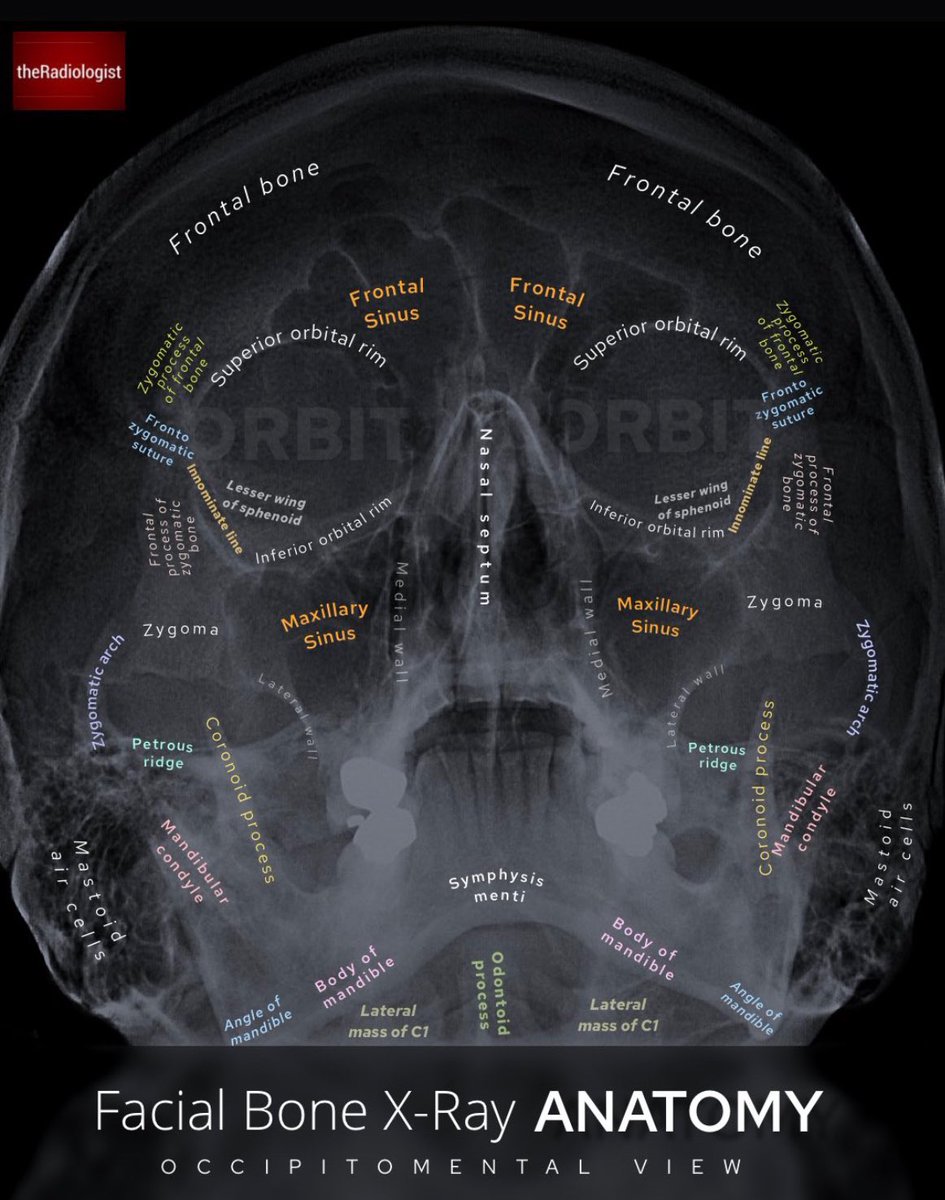 Ahmed Muharraq (@ahmadalmoharrg) on Twitter photo 