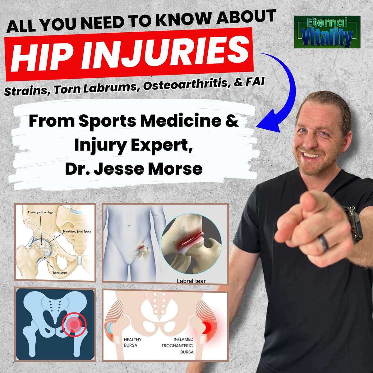 DrJesseMorse's tweet photo. Episode 21 of @EternalVitPod is now live and available to view

In this week's episode I cover a very common type of injuries: the hip. 

The podcast is broken down into the following categories: 

1. How do hip injuries usually present?
2. Anatomy of the Hip
3. Osteoarthritis
4. Femoroacetabular Impingement (FAI)
5. Treatment Options