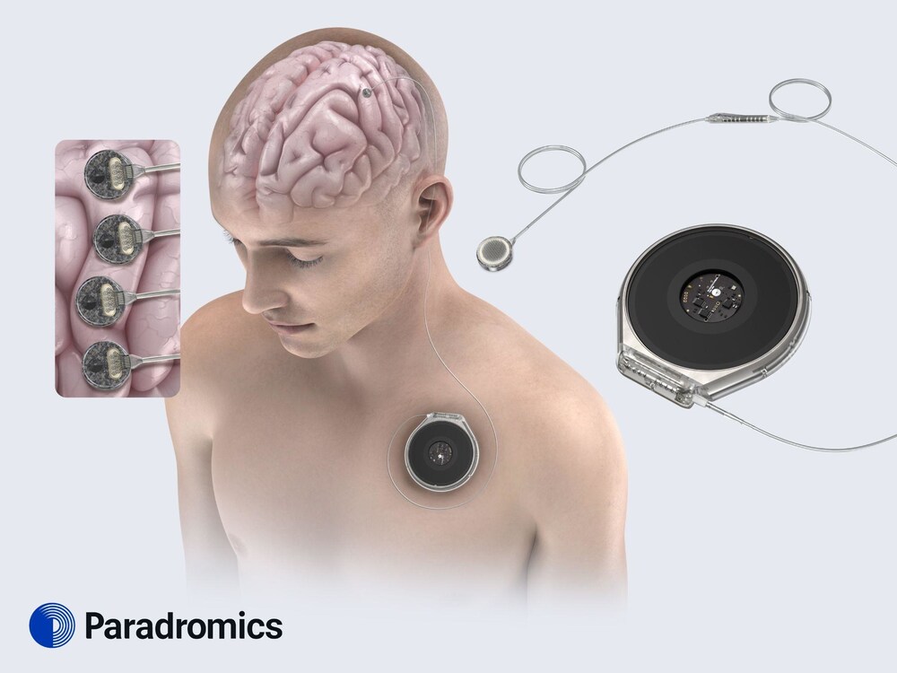 paradromics's tweet photo. 📣Paradromics has been accepted into the U.S. FDA’s newest accelerator program (TAP) and we have received our second Breakthrough Device Designation! These programs offer an expedited review process for transformative medical devices (like #BCIs🧠). 
https://t.co/wpqfhAHIhY https://t.co/i13OqLkUMg