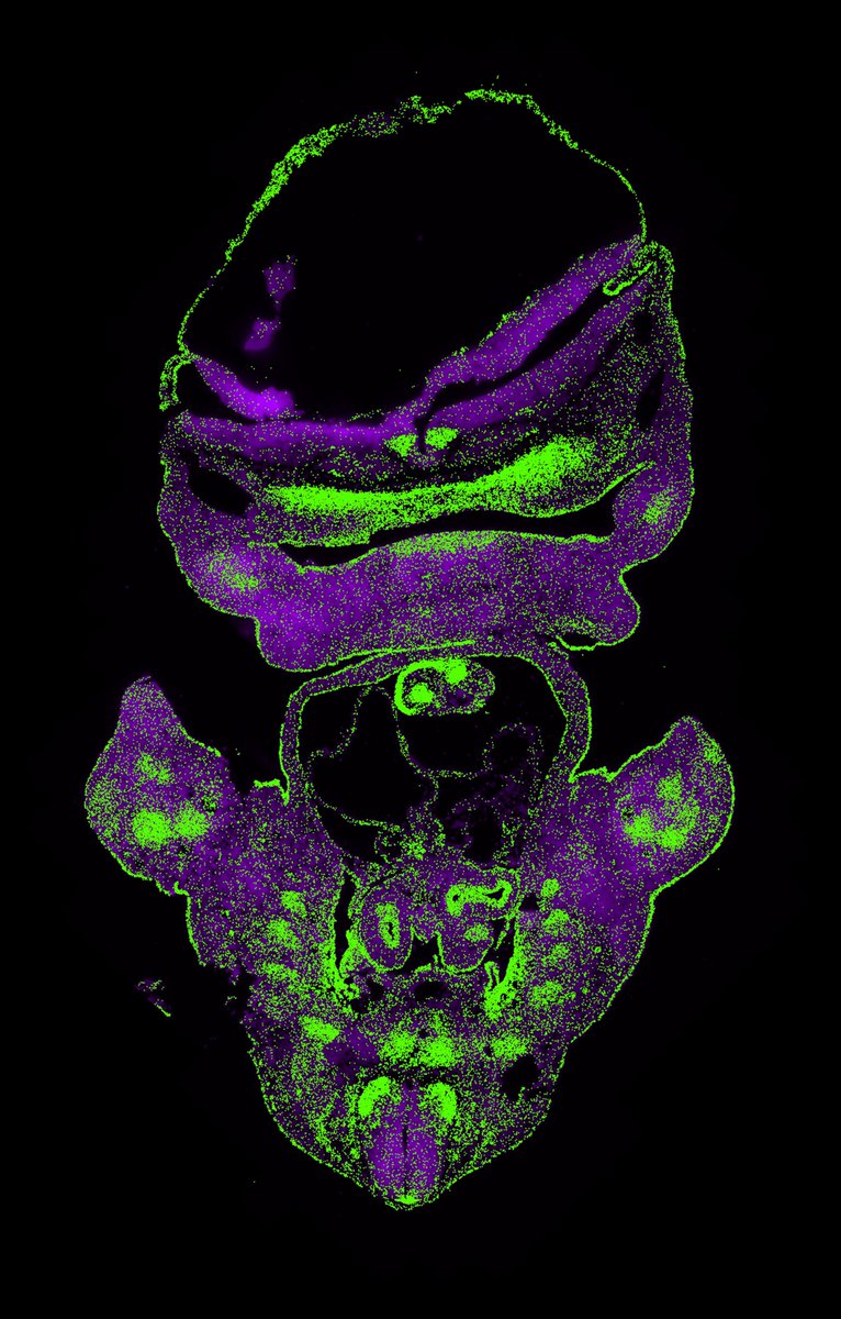 Dr. Anastassia Voronova (@amvoronova) on Twitter photo I am super excited to share our paper published today in <a href="/NatureComms/">Nature Communications</a>! Have you heard about heart-brain axis? Here we asked why heart defects are prevalent in children with neurodevelopmental disorders, such as the rare KBG syndrome. rdcu.be/dMm5w 1/9 I am super excited to share our paper published today in <a href="/NatureComms/">Nature Communications</a>! Have you heard about heart-brain axis? Here we asked why heart defects are prevalent in children with neurodevelopmental disorders, such as the rare KBG syndrome. rdcu.be/dMm5w 1/9