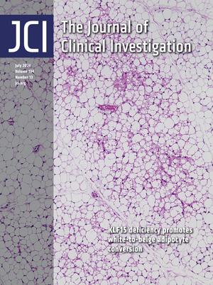 Eric Topol (@erictopol) on Twitter photo If only we could convert some of our abundant white fat tissue to brown or beige fat, it would help vs obesity, glucose dysregulation, and inflammation. A paper on the discovery of the mechanism to achieve this goal and the cover of the new <a href="/jclinicalinvest/">Journal of Clinical Investigation</a> <a href="/UCSF/">UC San Francisco</a> If only we could convert some of our abundant white fat tissue to brown or beige fat, it would help vs obesity, glucose dysregulation, and inflammation. A paper on the discovery of the mechanism to achieve this goal and the cover of the new <a href="/jclinicalinvest/">Journal of Clinical Investigation</a> <a href="/UCSF/">UC San Francisco</a>