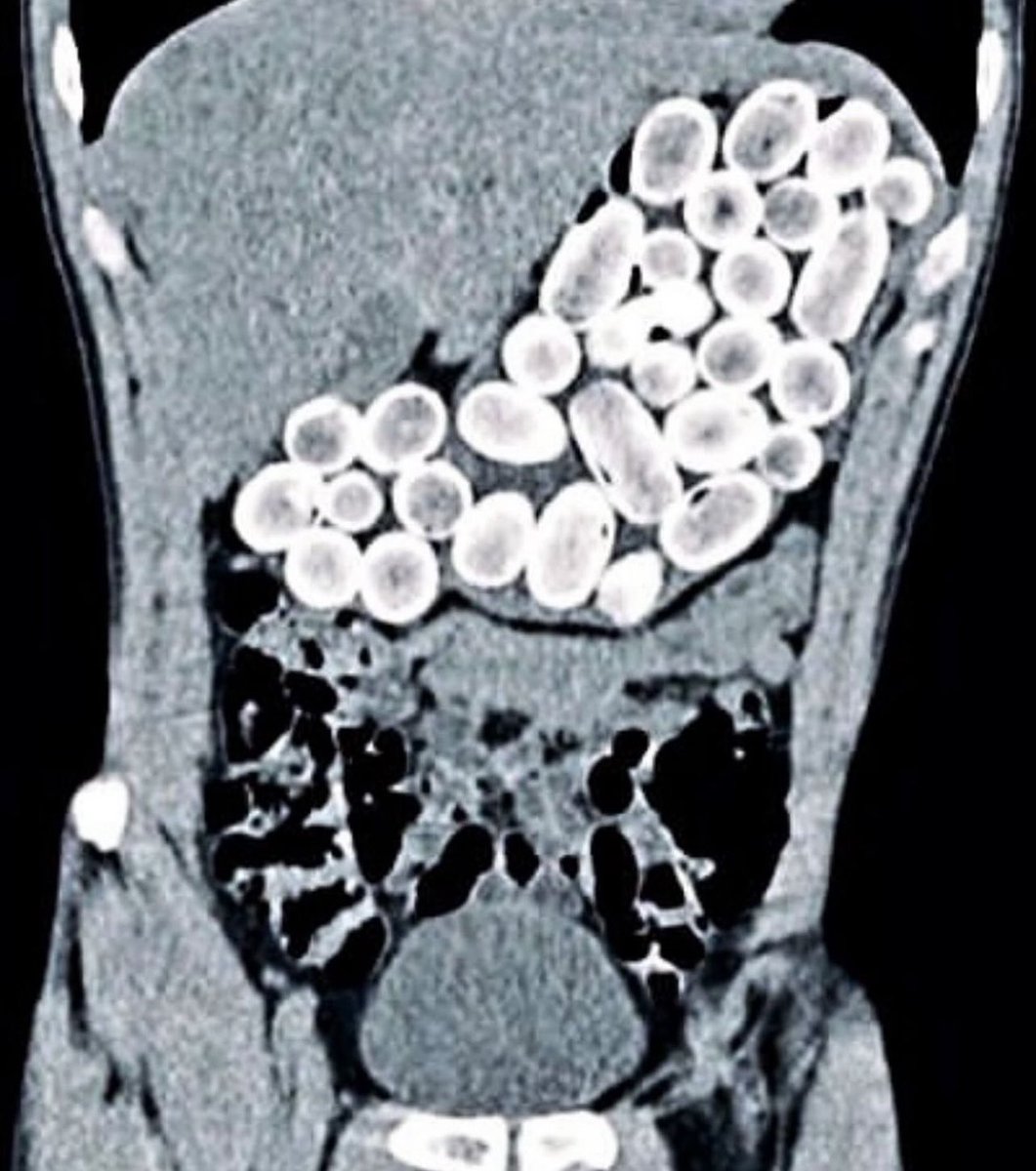 Keith Siau tweet media