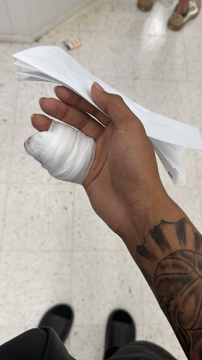 crushed my finger today at work 🥲