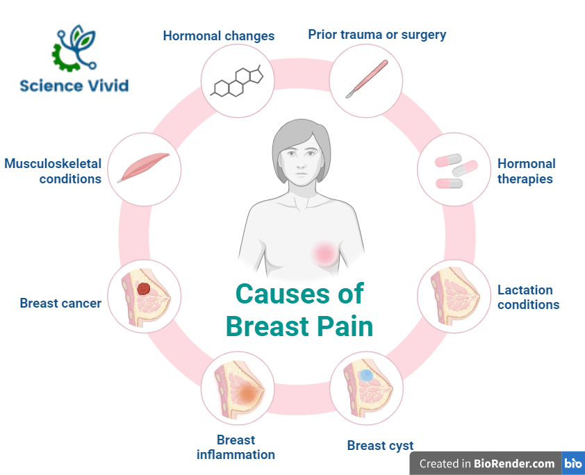 SCIENCEVIVID2's tweet photo. Breast cancer is caused by the uncontrollable proliferation of breast cells. It occurs when breast cells mutate and proliferate uncontrollably, resulting in a mass of tissue called tumour. 
https://t.co/uyrvj2REzz
#sciencevivid #breastcancer https://t.co/uzwUK54MU8
