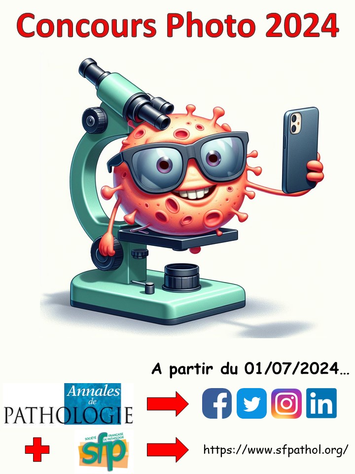 Annales de Pathologie (@annpathol) on Twitter photo 🔬 La Société Française de Pathologie et les Annales de Pathologie s'associent pour l'édition 2024 du concours photo 📸
⏳ Vous avez jusqu'au 1e octobre pour y participer!
👉 Toutes les infos sont ici : docs.google.com/forms/d/1i7Vk7…
#pathart #pathology #francophonepath
<a href="/SFPathol/">Société Française de Pathologie</a> 🔬 La Société Française de Pathologie et les Annales de Pathologie s'associent pour l'édition 2024 du concours photo 📸
⏳ Vous avez jusqu'au 1e octobre pour y participer!
👉 Toutes les infos sont ici : docs.google.com/forms/d/1i7Vk7…
#pathart #pathology #francophonepath
<a href="/SFPathol/">Société Française de Pathologie</a>