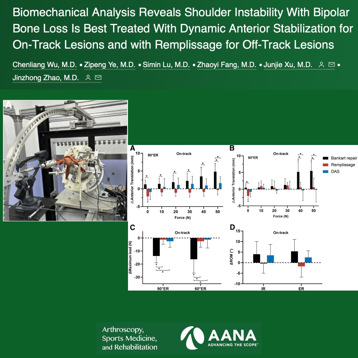 ArthroscopyJ's tweet photo. Dynamic anterior stabilization could be recommended to treat on-track bipolar bone loss with less biomechanical adverse effects, whereas remplissage might be the preferred procedure to address off-track bipolar bone loss for better stability. #ShoulderStabilization https://t.co/VVTwyKSnDJ