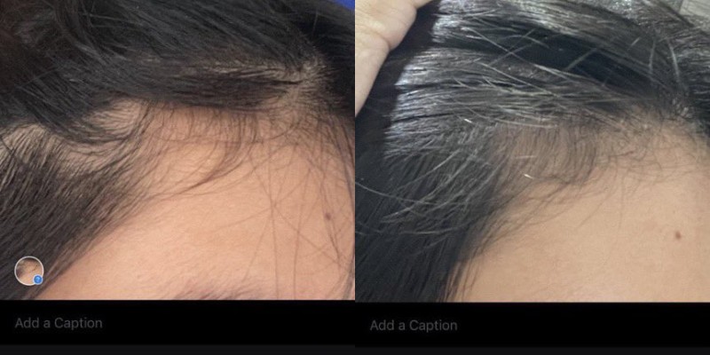 Treatment Sampoo rambut rontok!

- A Thread -