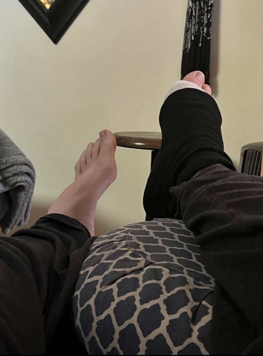 desiringsole's tweet photo. On the mend... 

#feet #footfetısh #gay #malefeet #feetfinder #feetpic #malefootworship #gayfeet  #jockfeet  #malefootfetish  #malesoles https://t.co/ayXpgT9kNE