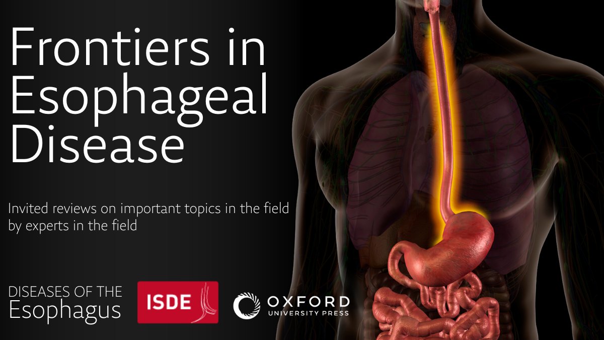 DOTEsophagus's tweet photo. Check out this State of the Art Review on gastric conduit reconstruction after esophagectomy - now available and free to access for all ISDE members in our Frontiers in Esophageal Disease series.
https://t.co/yuDYHgXZun
#Surgery #Esophagectomy #SoMe4Surgery #TechnicalTips https://t.co/2AJKsr6fXf