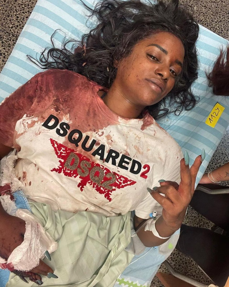 (via <a href="/HenMazzig/">Hen Mazzig</a> )
“Ik moest kiezen tussen levend verbrand worden of neergeschoten worden.”
Op 7 oktober 2023 werd Mazal Tazazo aangevallen door Hama terwijl ze met haar vrienden probeerde te ontsnappen aan het Nova-muziekfestival.
‘We zijn erin geslaagd Route 232 te bereiken, wat