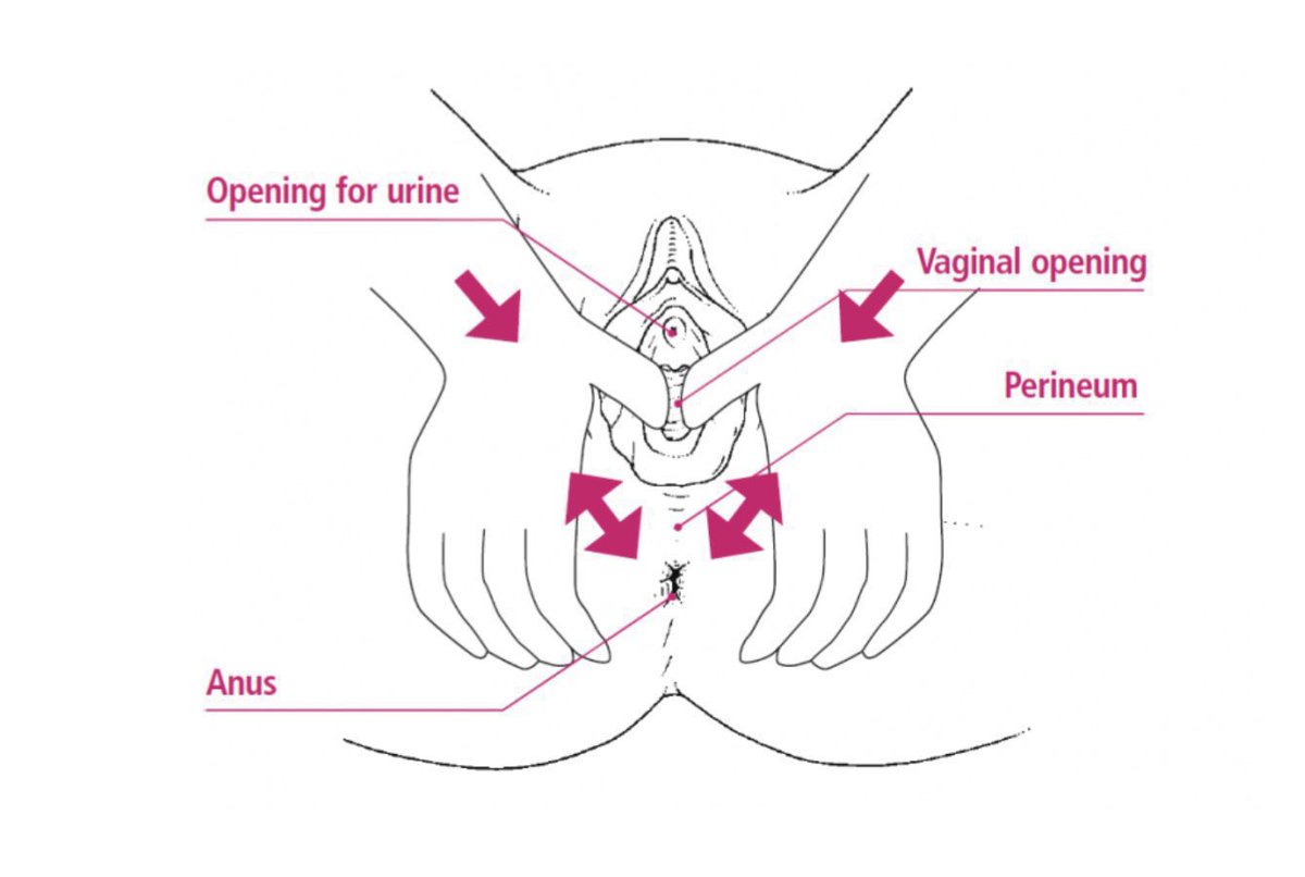 ezzahnor's tweet photo. Ibu hamil yg nk bersalin tanpa koyak, once masuk 3rd trimester, dah boleh start buat perineal massage.

Bila selalu buat perineal massage ni, tissue dekat area situ akan jd more elastic.

So membantu utk bersalin tanpa koyak👍🏻 https://t.co/9thdiNItRh