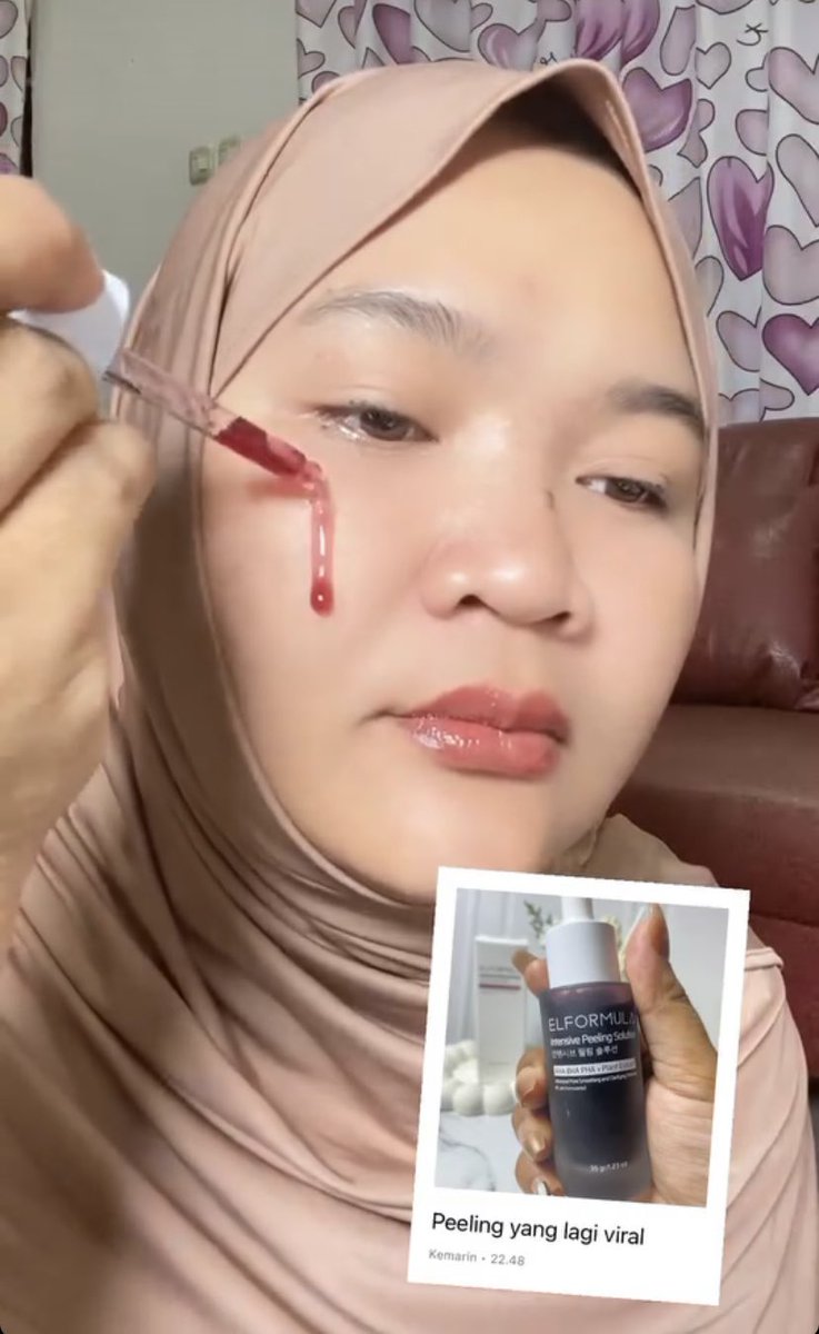 Wiwizilaa's tweet photo. Waktu yang diperlukan untuk
Elformula Peeling solution sangat singkat dibanding peeling solution brand lain yaitu 60 detik untuk mencegah eksfoliasi yang berlebihan yang dapat menyebabkan rusaknya skin barrier dan timbulnya iritasi. @ElformulaID https://t.co/Uj6G7V4mqM