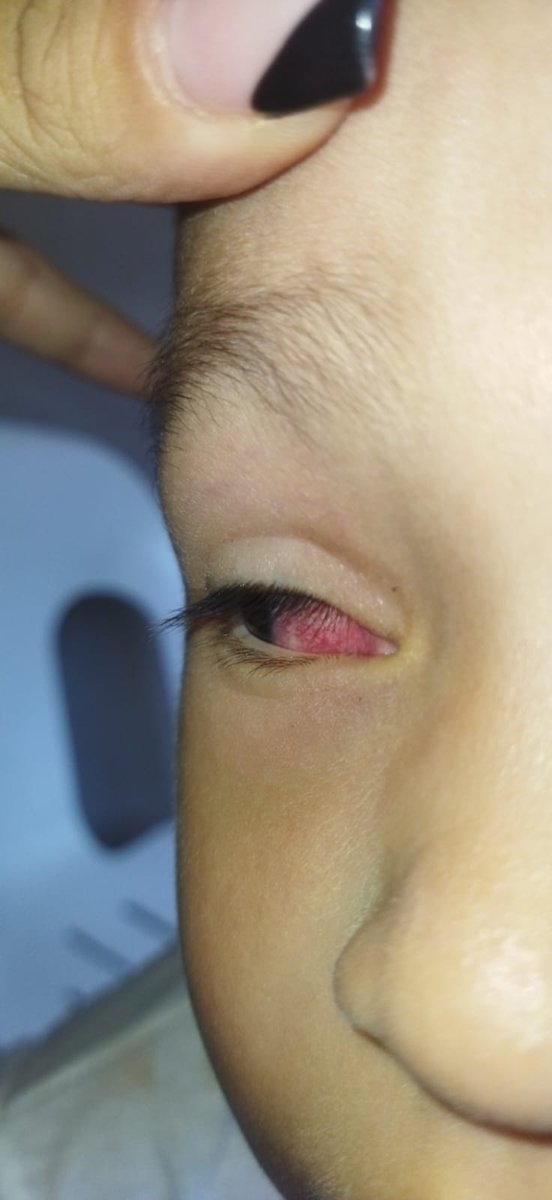 Bahçeli evler şeyh zayit çocuk yurdunda oğlum Adnan berk kanıdinç dövülerek öldürüldü ve aile bakanı darp yok diyor peki bu yurtta çekilen 24 ağustos 2023 tarihinde ki darp ı kim yaptı. Ben kendi gözlerimle gördüm oğlumun yüzünü forografları var 1 tanesini paylaşıyorum. Darp var