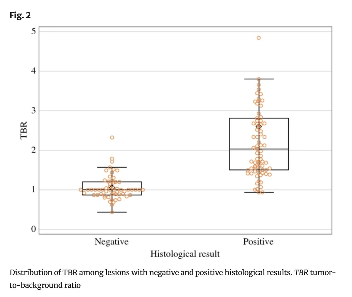 Annals of Surgical Oncology (@annsurgoncol) on Twitter photo July Issue: #RadioGuidedSurgery with a New-Generation β-Probe for Radiolabeled #Somatostatin Analog, in Patients with Small Intestinal #NeuroendocrineTumors <a href="/BertaniEmilio/">Emilio Bertani</a> <a href="/FrancescoCeci13/">Francesco Ceci</a>
rdcu.be/dMowH
<a href="/AradhyaNigamMD/">Aradhya Nigam, MD</a>
<a href="/SyedAAhmad5/">Syed A. Ahmad</a> July Issue: #RadioGuidedSurgery with a New-Generation β-Probe for Radiolabeled #Somatostatin Analog, in Patients with Small Intestinal #NeuroendocrineTumors <a href="/BertaniEmilio/">Emilio Bertani</a> <a href="/FrancescoCeci13/">Francesco Ceci</a>
rdcu.be/dMowH
<a href="/AradhyaNigamMD/">Aradhya Nigam, MD</a>
<a href="/SyedAAhmad5/">Syed A. Ahmad</a>