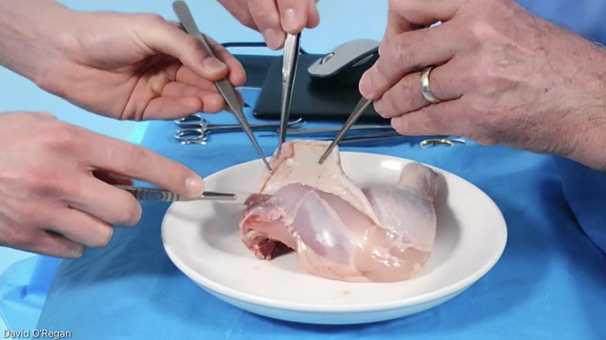 BBASS_skills's tweet photo. Really impressed at my son’s surgical skills- I assisted him live six moths ago - instrument handling was very good and one handed surgical knot remembered 👊🙏. He does not want to do surgery but has the skills because he has learnt the basics 🙏👊🥋Respect https://t.co/lUjnSiLdQm