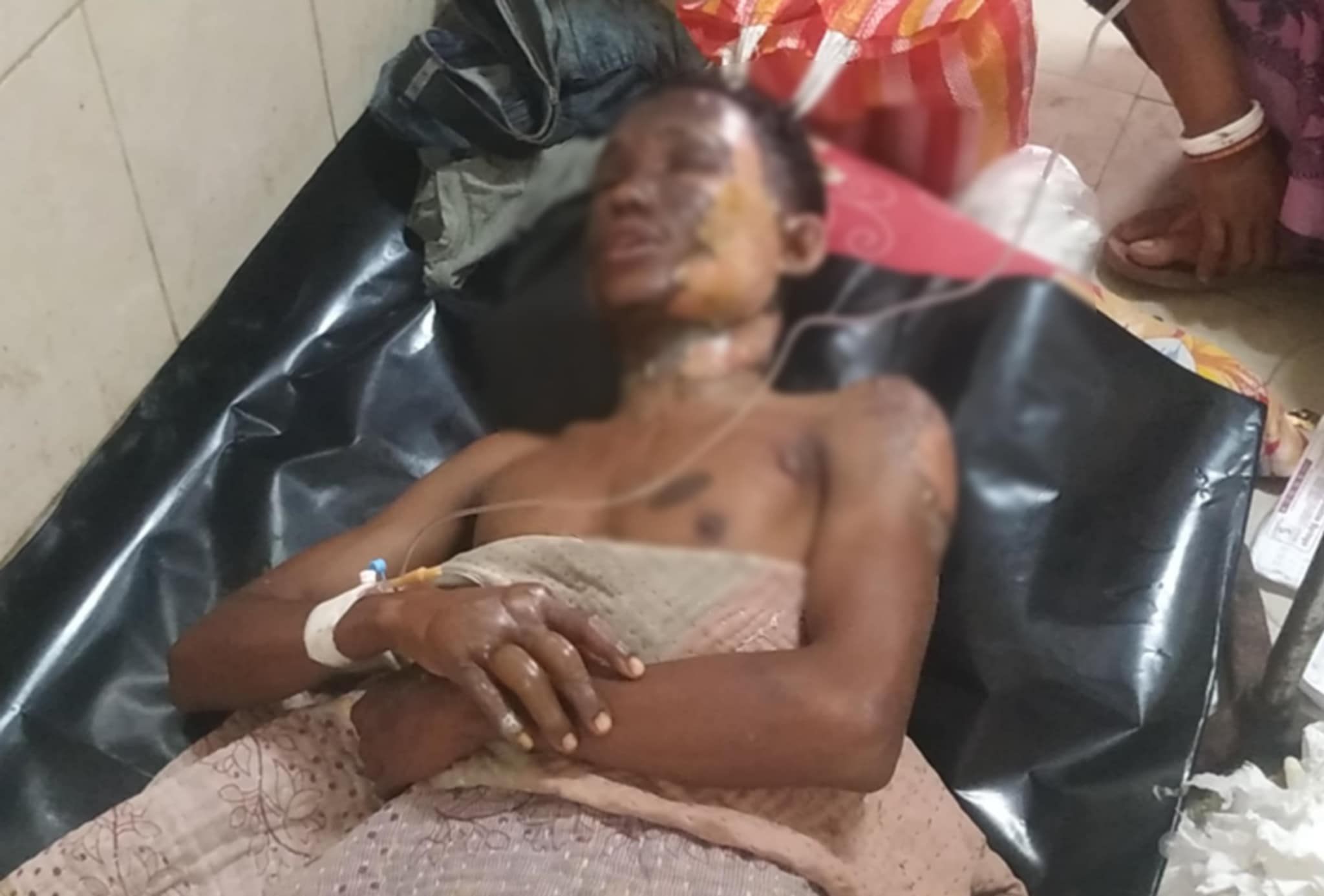 ঠাকুরগাঁওয়ে মোবাইলে টিকটক দেখা নিয়ে বিবাদ, বন্ধুর গায়ে পেট্রোল ঢেলে আগুন