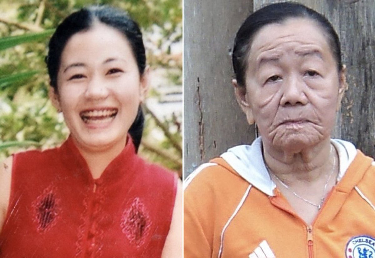 creepydotorg's tweet photo. In 2008, a 23-year-old Vietnamese woman suffered from a mysterious food allergy that aged her about 50 years in just a few days. https://t.co/5F06ozgzyn
