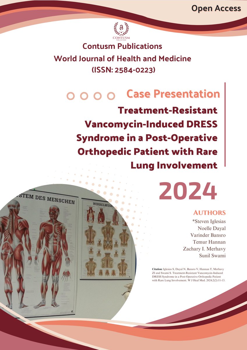 Contusm_Publish's tweet photo. Treatment-Resistant Vancomycin-Induced DRESS Syndrome in a Post-Operative Orthopedic Patient with Rare Lung Involvement
https://t.co/xhTyteCZ71

#Orthopedics #lung #RareDiseases #HealthCare #Pharmacology #MedicalResearch #medicine #health #ClinicalTrials https://t.co/8AngydbXGt