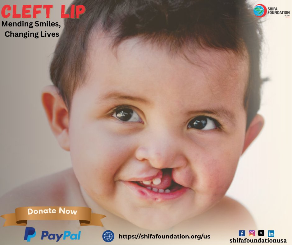 UsaShifa's tweet photo. Mend a smile, change a life!
Join @UsaShifa campaign, "Cleft Lip: Mending Smiles, Changing Lives." A $300 donation can sponsor a cleft lip procedure and transform a child's future.
Donate now:https://t.co/EIhlWRh6KU
Through Bank: Call us for details: +1 (630) 743 6953
#cleftlip https://t.co/1eSPxz3t3j