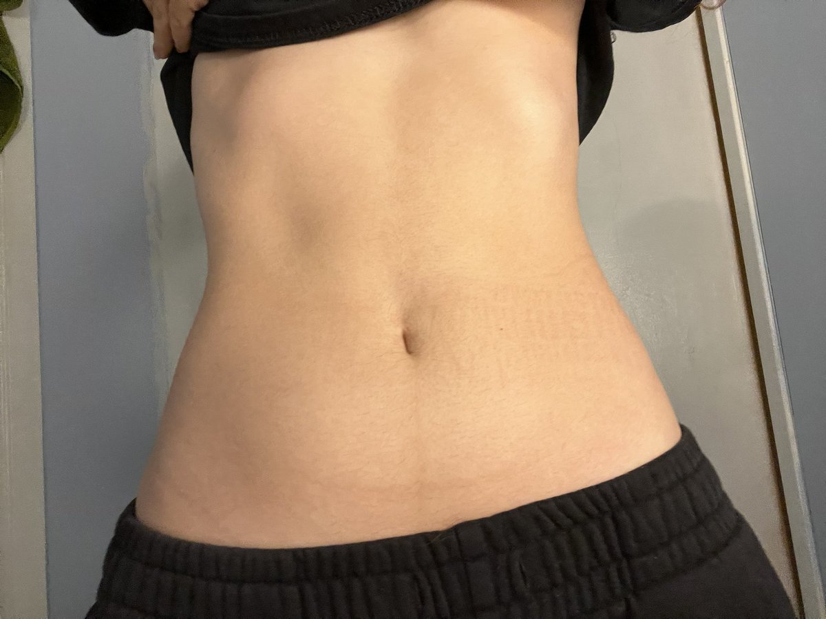 thinspo4L's tweet photo. morning bc i don’t have a scale rn bmi guesses?? https://t.co/zX4PNWdKyd