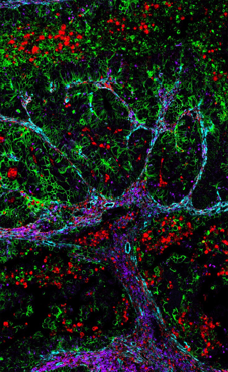Immunology Center of Georgia at Augusta University (@immunologyau) on Twitter photo IMMCG postdoc <a href="/jaeger_natalia/">Natalia Jaeger</a> received the Distinguished Creativity Award for the Art of Science at the <a href="/GACancerCenter/">Georgia Cancer Center</a> Research Retreat. Congrats Natalia! <a href="/MCG_AUG/">MCG</a> IMMCG postdoc <a href="/jaeger_natalia/">Natalia Jaeger</a> received the Distinguished Creativity Award for the Art of Science at the <a href="/GACancerCenter/">Georgia Cancer Center</a> Research Retreat. Congrats Natalia! <a href="/MCG_AUG/">MCG</a>