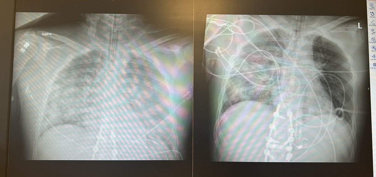 Hana Baig, MD tweet media