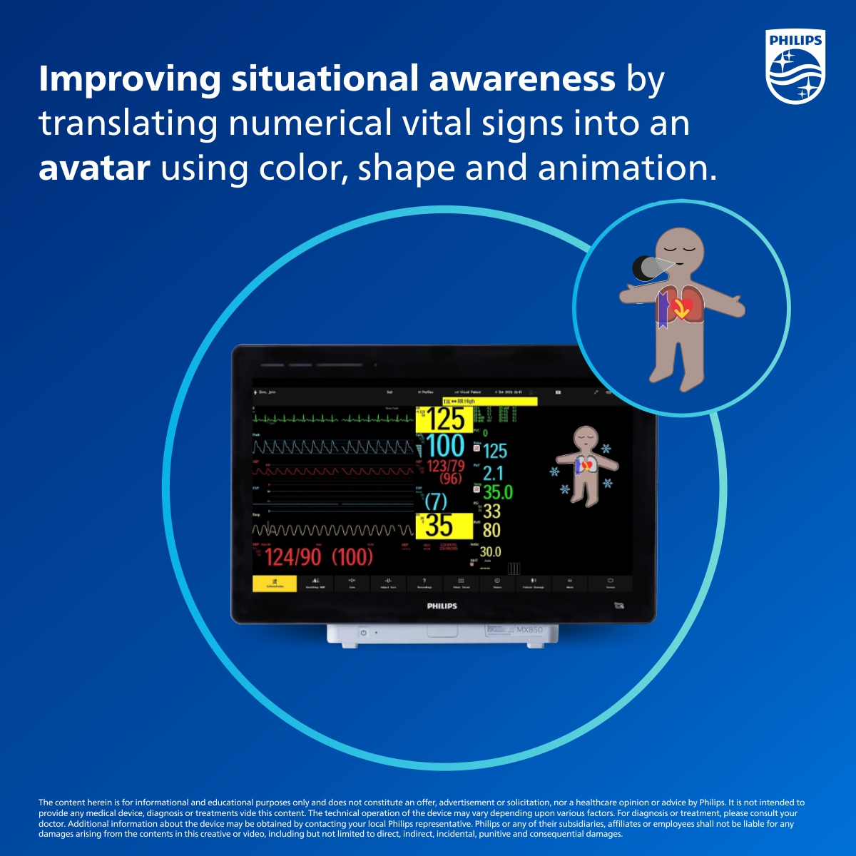 Discover Visual Patient Avatar and open your eyes to enhanced situational awareness.
Know how Philips Visual Patient Avatar can enhance your peripheral view, delivering additional insights. Know more: to.philips/60129G5dO