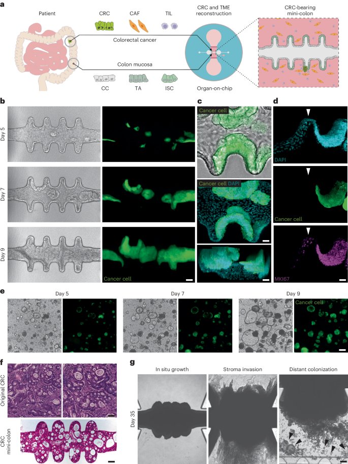 Patient-derived mini-colons enable long-term modeling of tumor–microenvironment complexity go.nature.com/3LblcjH