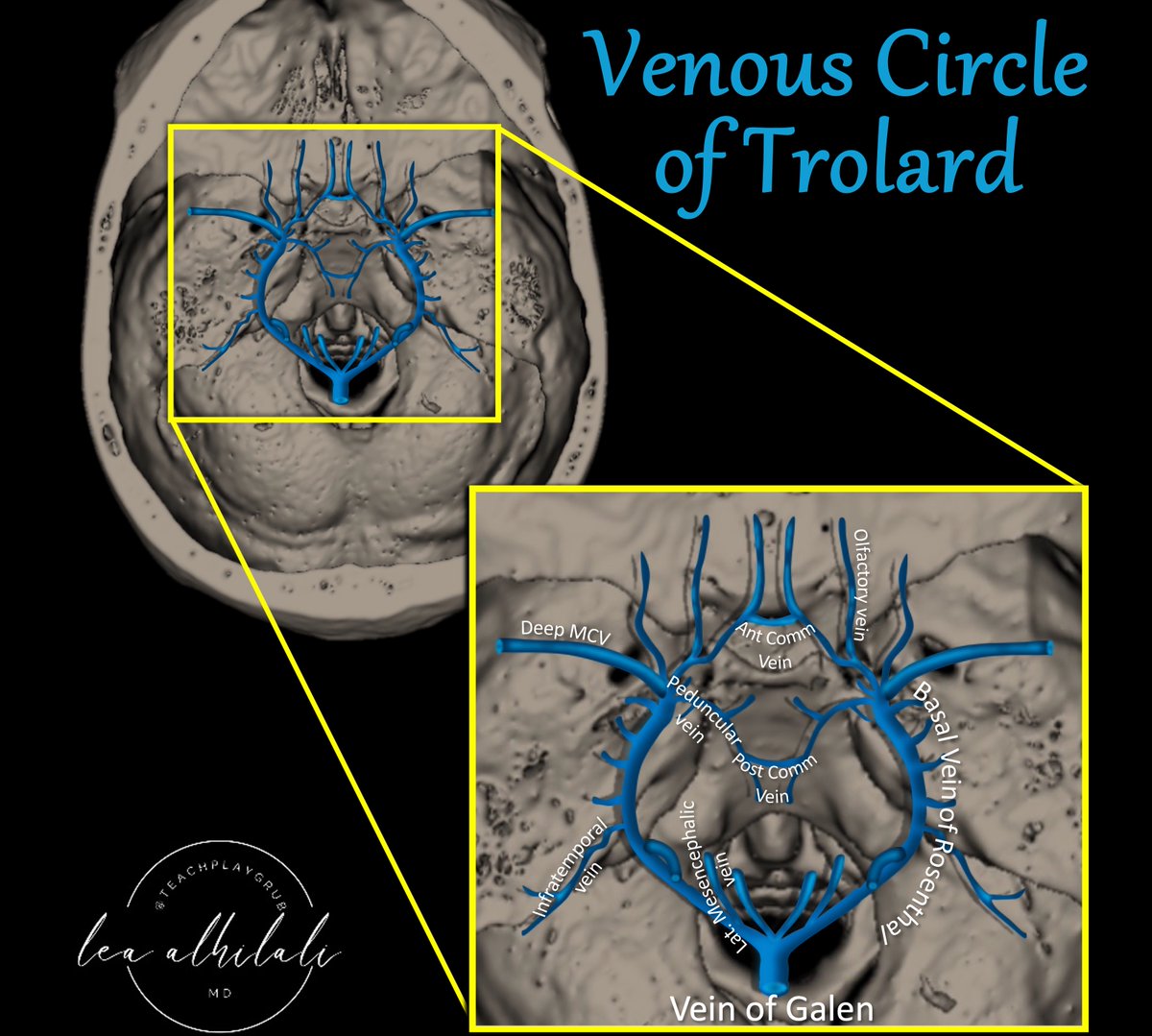Think you know brain vascular anatomy? 

How many brain vascular circles do you know?

Everyone knows the Circle of Willis, but few know its venous counterpart: Venous Circle of Trolard!

Can you see the polygon on top of a❤️??

Venous Circle of Trolard is the midline connection