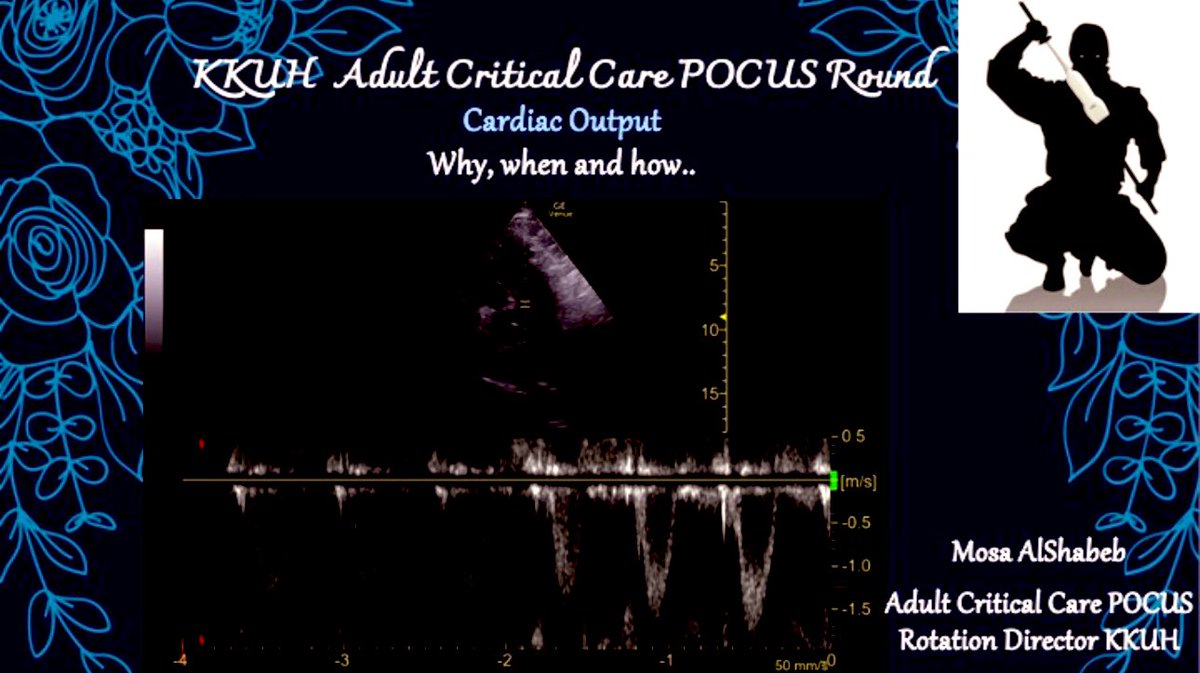 CKsumc's tweet photo. KKUH Adult Critical Care POCUS Round will be: 
 📆 Wednesday 03/07
 🕢 07:30 p.m  

Topic: Cardiac output measurement; when, why and how?

Presented by Dr. Mosa AlShabeb (ICU POCUS rotation director)

Join Zoom Meeting
https://t.co/rhgcOvncgx

ID: 963 8202 4147
Pass: 413749 https://t.co/XQy6A8DX54