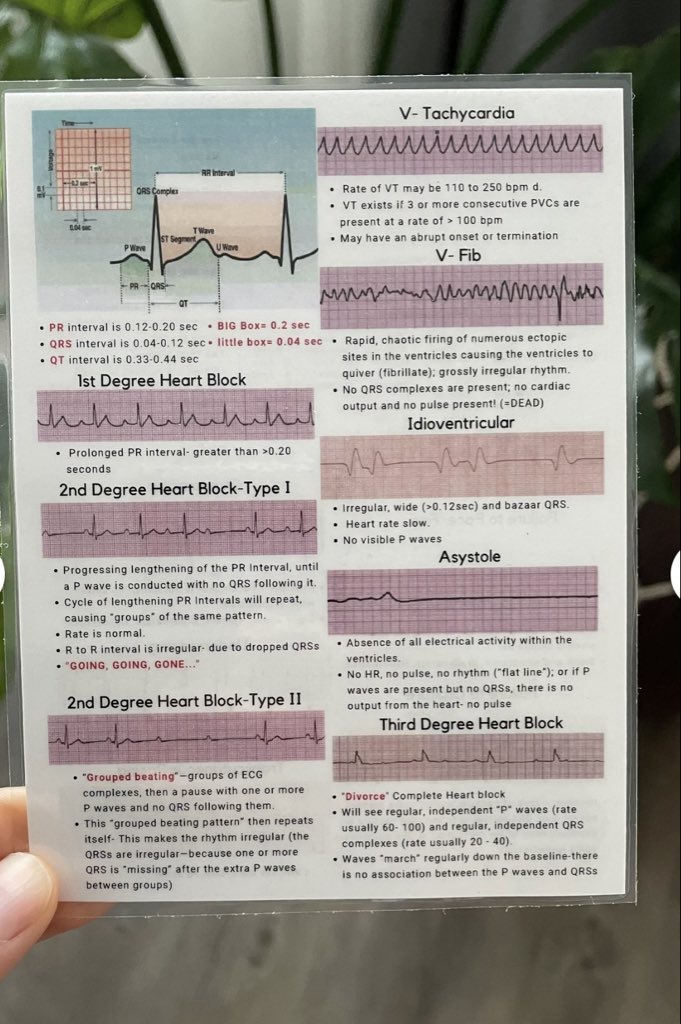 OGdukeneurosurg's tweet photo. EKG Help https://t.co/F0oz5JZbOH