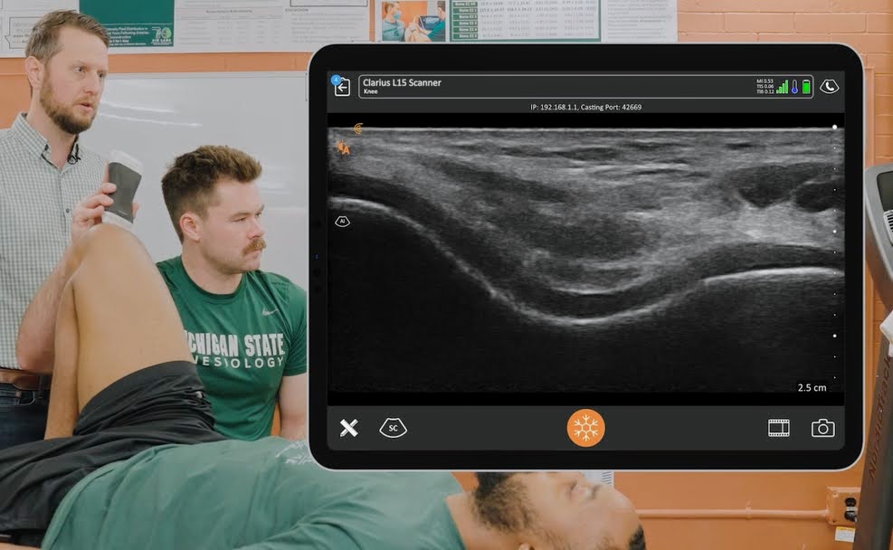 Harkey_MS's tweet photo. 🎉🥳 It's @AIRLabsMSU grad student spotlight time! 🌟 Today we're shining bright on @goreycrozier! 🔍 2 years into his PhD, Corey's been the driving force behind our ultrasound imaging research. 🚀 He's taking us to new heights! 🌠 #GradStudentSuccess https://t.co/mRAn6cF9h4