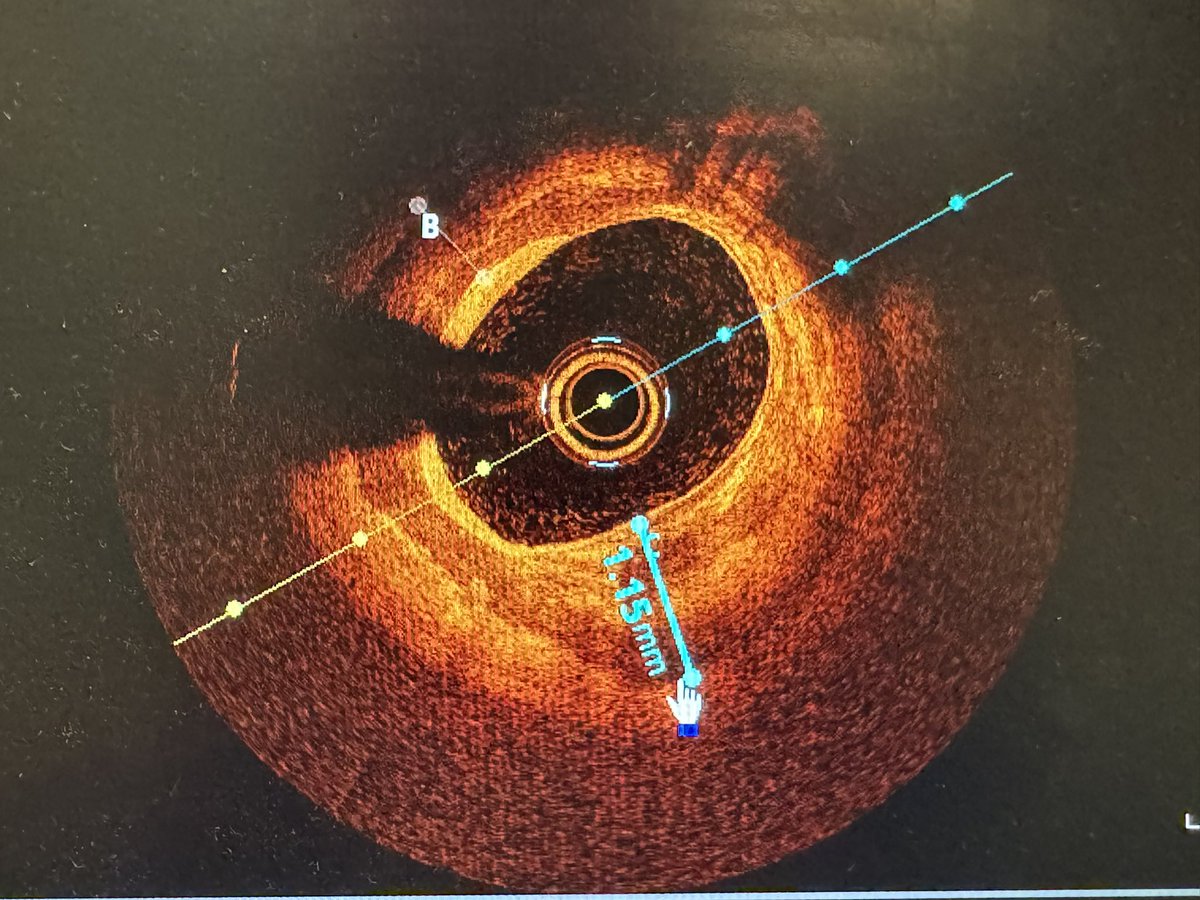 Dr Koltowski tweet media