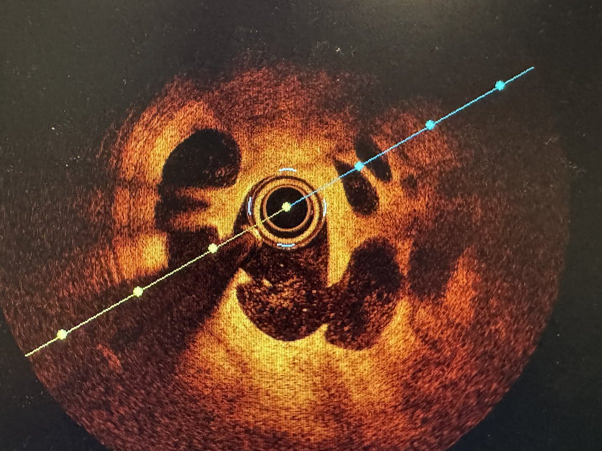 Dr Koltowski tweet media