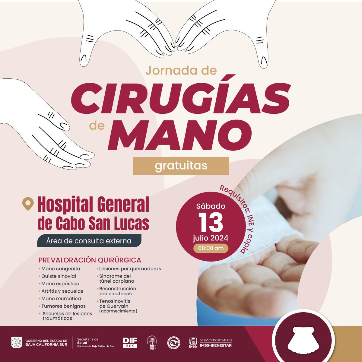 #Entérate | Próxima Jornada de Cirugía de Manos. Quienes requieran de esta atención favor de acudir a la prevaloración quirúrgica el sábado 13 de julio partir de las 9:00 horas, en el Hospital General de #CaboSanLucas.