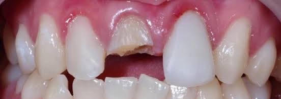 jessie — koass dokter gigi🦷 tweet media