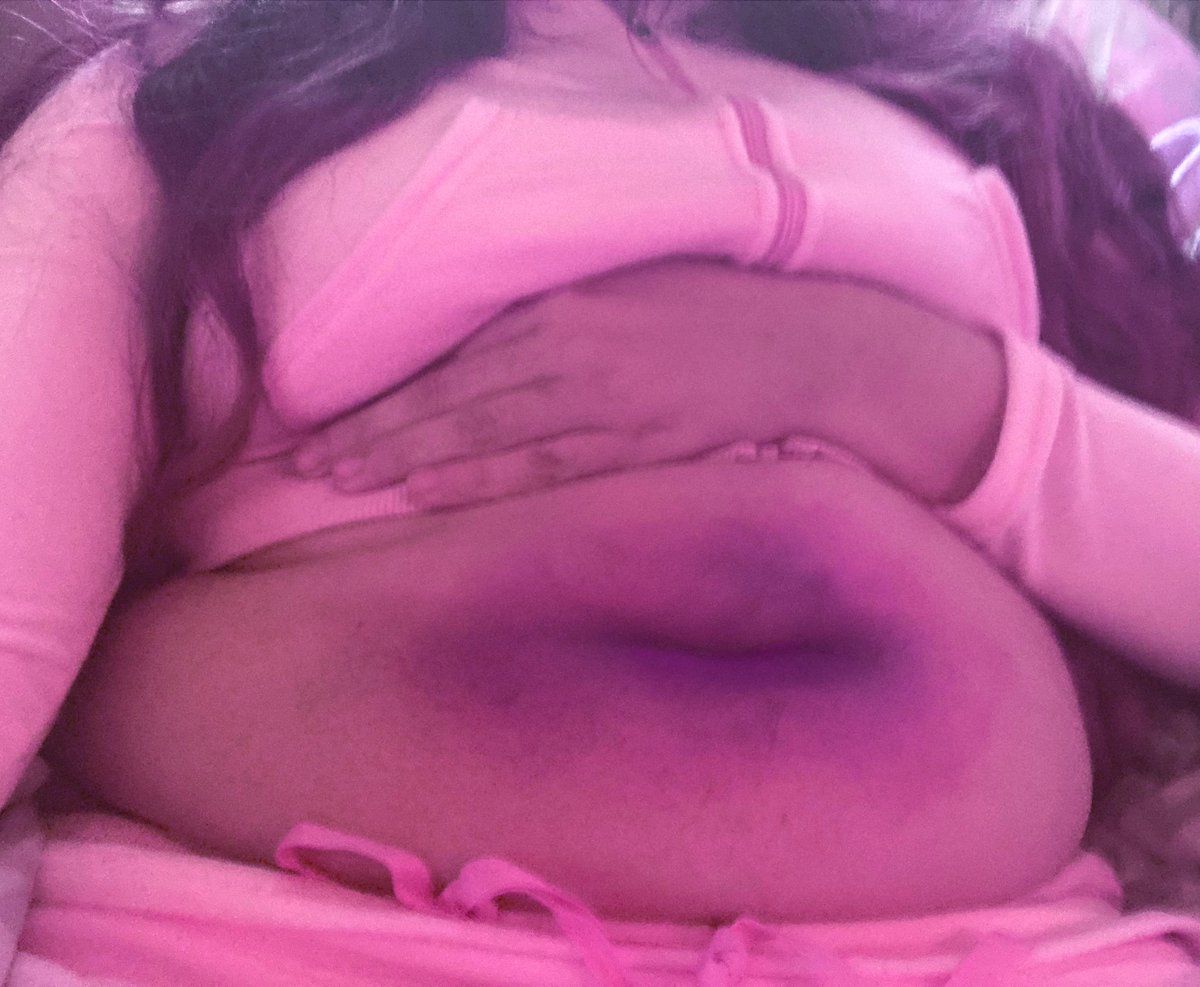 bluberryfatcake's tweet image. oh, well, i, uh, yknow how it is with gum, and berries, and berry gum,,,, 💦💦