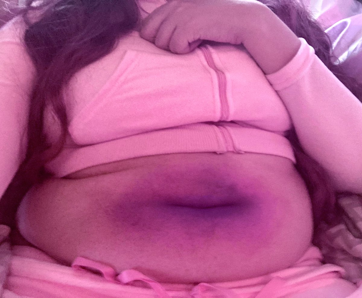 bluberryfatcake's tweet image. oh, well, i, uh, yknow how it is with gum, and berries, and berry gum,,,, 💦💦